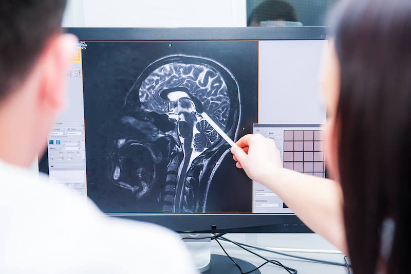 Doctors Examining An Xray Of Brains